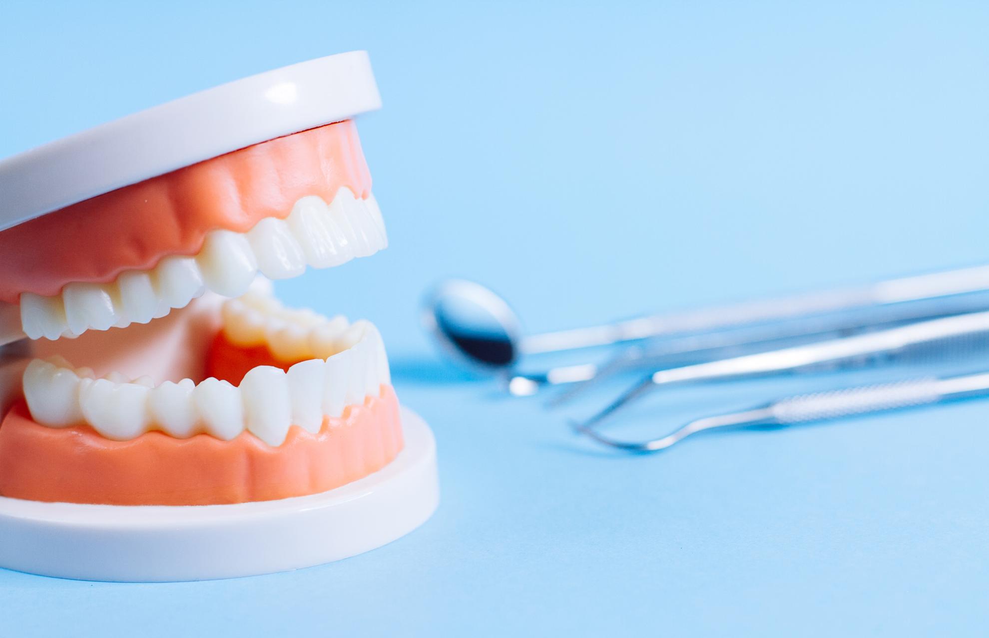 インプラントの歯周病「インプラント周囲炎」とは？おもな症状や原因